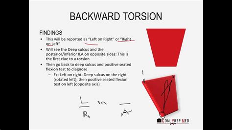 sacral torsion diagnosis